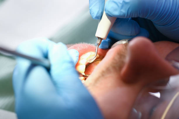 Best Walk-In Emergency Dental Services in Collinwood, TN