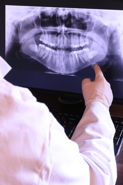 Best Knocked-Out Tooth (Avulsed Tooth) Treatment in Collinwood, TN